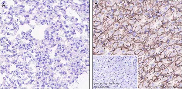 Immunohistochemistry (Formalin/PFA-fixed paraffin-embedded sections) - Anti-Claudin 18.2 antibody [EPR19202-244] - BSA and Azide free (AB242079)