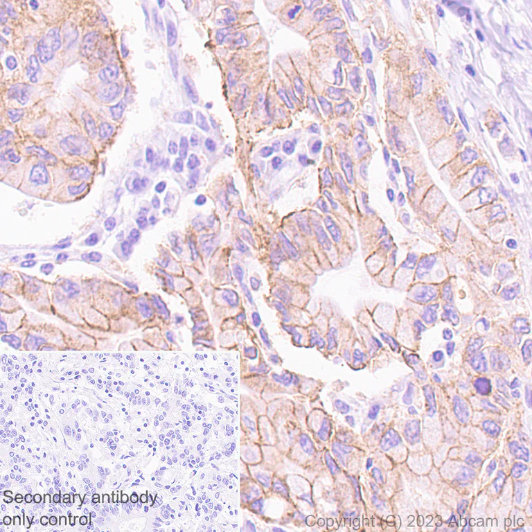 Immunohistochemistry (Formalin/PFA-fixed paraffin-embedded sections) - Anti-Claudin 18.2 antibody [EPR19202-244] - BSA and Azide free (AB242079)