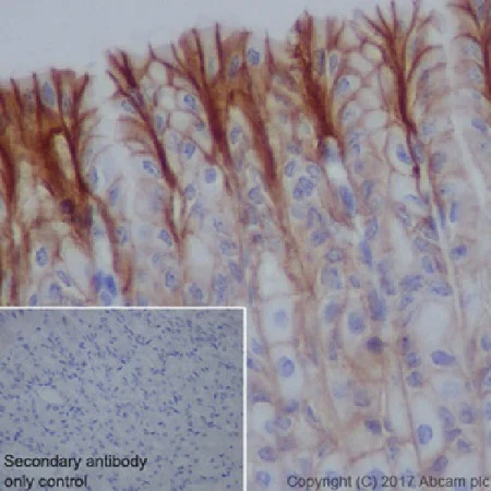 Immunohistochemistry (Formalin/PFA-fixed paraffin-embedded sections) - Anti-Claudin 18.2 antibody [EPR19202] (AB222512)