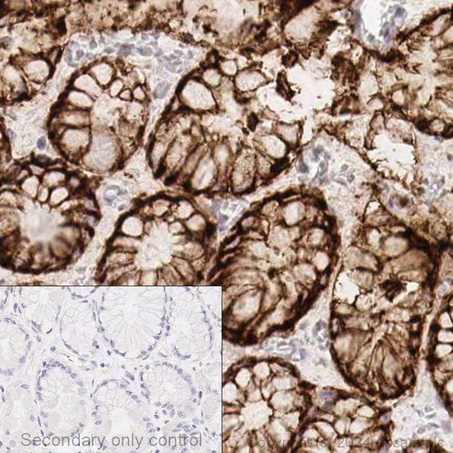 Immunohistochemistry (Formalin/PFA-fixed paraffin-embedded sections) - Anti-Claudin 18.2 antibody [EPR19202] (AB222512)