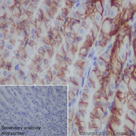 Immunohistochemistry (Formalin/PFA-fixed paraffin-embedded sections) - Anti-Claudin 18.2 antibody [EPR19202] (AB222512)