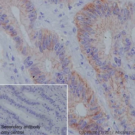 Immunohistochemistry (Formalin/PFA-fixed paraffin-embedded sections) - Anti-Claudin 18.2 antibody [EPR19202] (AB222512)