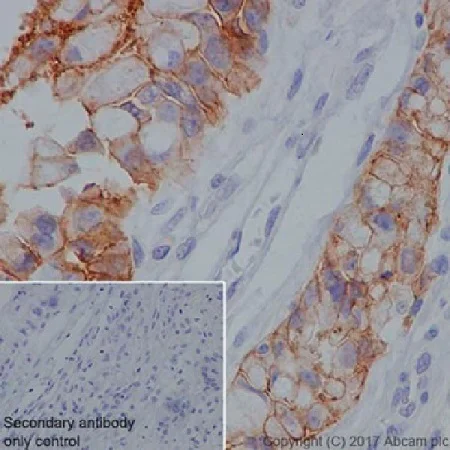 Immunohistochemistry (Formalin/PFA-fixed paraffin-embedded sections) - Anti-Claudin 18.2 antibody [EPR19202] (AB222512)