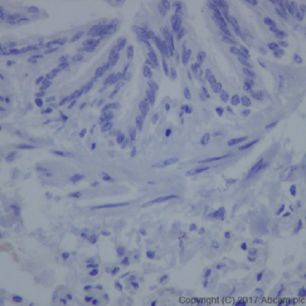 Immunohistochemistry (Formalin/PFA-fixed paraffin-embedded sections) - Anti-Claudin 18.2 antibody [EPR19202] - BSA and Azide free (ab240400), expandable thumbnail