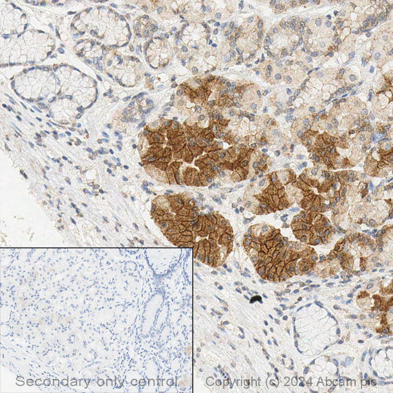 Immunohistochemistry (Formalin/PFA-fixed paraffin-embedded sections) - Anti-Claudin 18.2 antibody [EPR19202] - BSA and Azide free (AB240400)