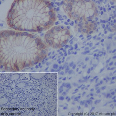Immunohistochemistry (Formalin/PFA-fixed paraffin-embedded sections) - Anti-Claudin 18.2 antibody [EPR19202] - BSA and Azide free (AB240400), expandable thumbnail