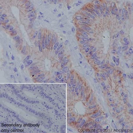 Immunohistochemistry (Formalin/PFA-fixed paraffin-embedded sections) - Anti-Claudin 18.2 antibody [EPR19202] - BSA and Azide free (ab240400), expandable thumbnail