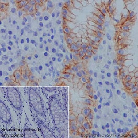 Immunohistochemistry (Formalin/PFA-fixed paraffin-embedded sections) - Anti-Claudin 18.2 antibody [EPR19202] - BSA and Azide free (AB240400), expandable thumbnail
