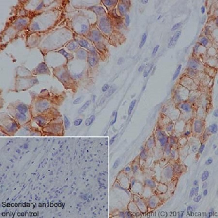 Immunohistochemistry (Formalin/PFA-fixed paraffin-embedded sections) - Anti-Claudin 18.2 antibody [EPR19202] - BSA and Azide free (AB240400), expandable thumbnail