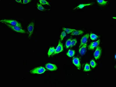 Immunocytochemistry/ Immunofluorescence - Anti-Claudin 20 antibody (AB236726)