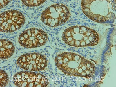 Immunohistochemistry (Formalin/PFA-fixed paraffin-embedded sections) - Anti-Claudin 3 antibody (AB52231)