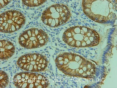 Immunohistochemistry (Formalin/PFA-fixed paraffin-embedded sections) - Anti-Claudin 3 antibody (AB52231)