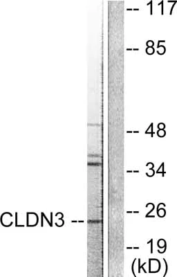 Western blot - Anti-Claudin 3 antibody (AB52231)