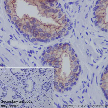 Immunohistochemistry (Formalin/PFA-fixed paraffin-embedded sections) - Anti-Claudin 3 antibody [EPR19971] - BSA and Azide free (AB222485)