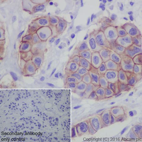 Immunohistochemistry (Formalin/PFA-fixed paraffin-embedded sections) - Anti-Claudin 3 antibody [EPR19971] - BSA and Azide free (AB222485)