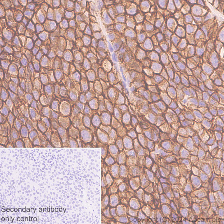 Immunohistochemistry (Formalin/PFA-fixed paraffin-embedded sections) - Anti-Claudin 3 antibody [EPR28731-2] (AB317319)