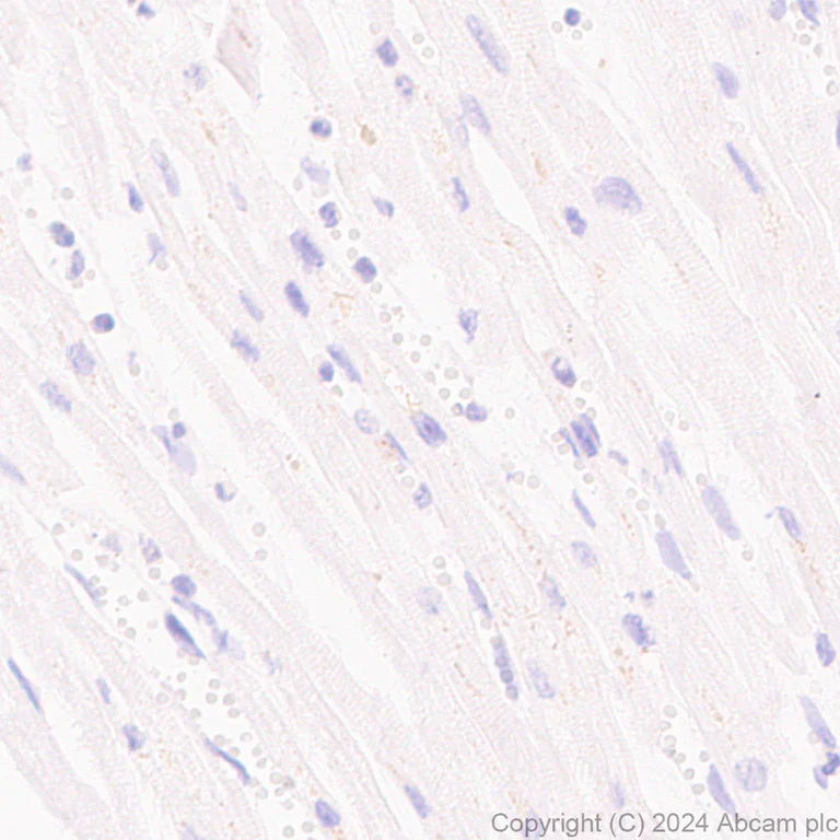 Immunohistochemistry (Formalin/PFA-fixed paraffin-embedded sections) - Anti-Claudin 3 antibody [EPR28731-2] (AB317319)