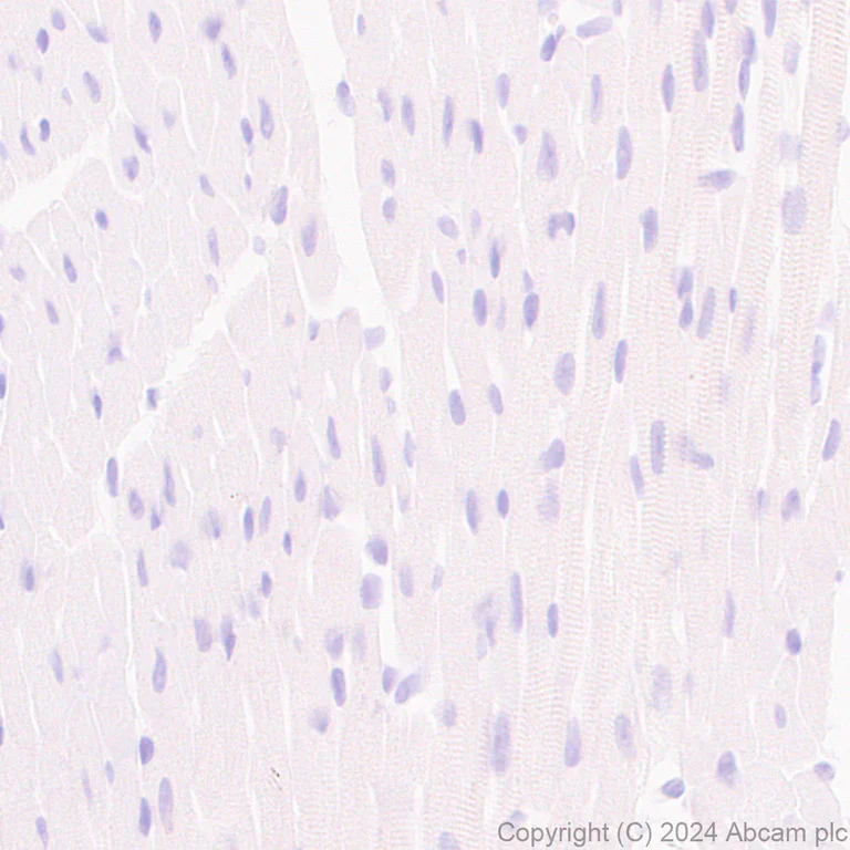 Immunohistochemistry (Formalin/PFA-fixed paraffin-embedded sections) - Anti-Claudin 3 antibody [EPR28731-2] (AB317319)