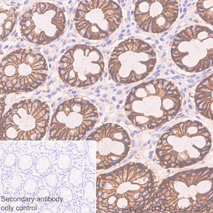 Immunohistochemistry (Formalin/PFA-fixed paraffin-embedded sections) - Anti-Claudin 3 antibody [EPR28731-2] - BSA and Azide free (ab317320), expandable thumbnail