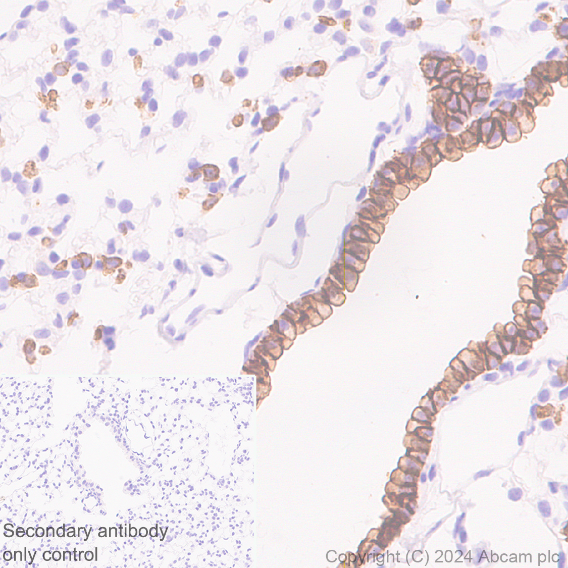 Immunohistochemistry (Formalin/PFA-fixed paraffin-embedded sections) - Anti-Claudin 3 antibody [EPR28731-2] - BSA and Azide free (ab317320), expandable thumbnail