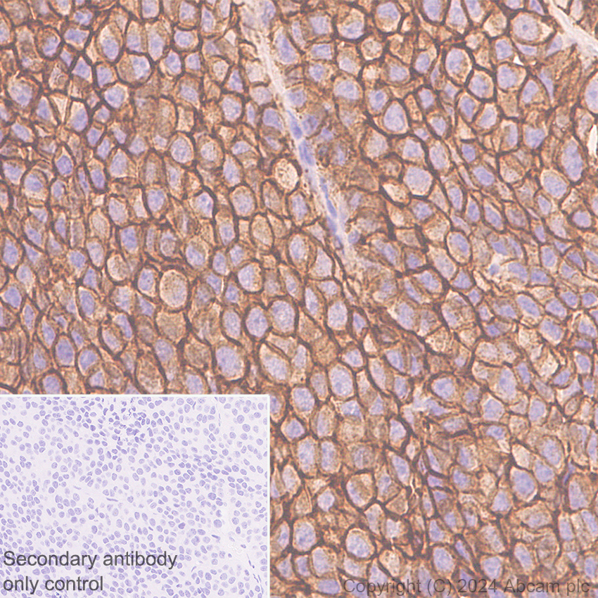 Immunohistochemistry (Formalin/PFA-fixed paraffin-embedded sections) - Anti-Claudin 3 antibody [EPR28731-2] - BSA and Azide free (ab317320), expandable thumbnail