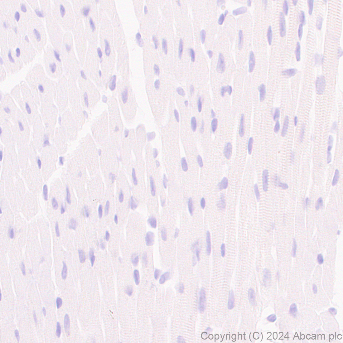 Immunohistochemistry (Formalin/PFA-fixed paraffin-embedded sections) - Anti-Claudin 3 antibody [EPR28731-2] - BSA and Azide free (ab317320), expandable thumbnail