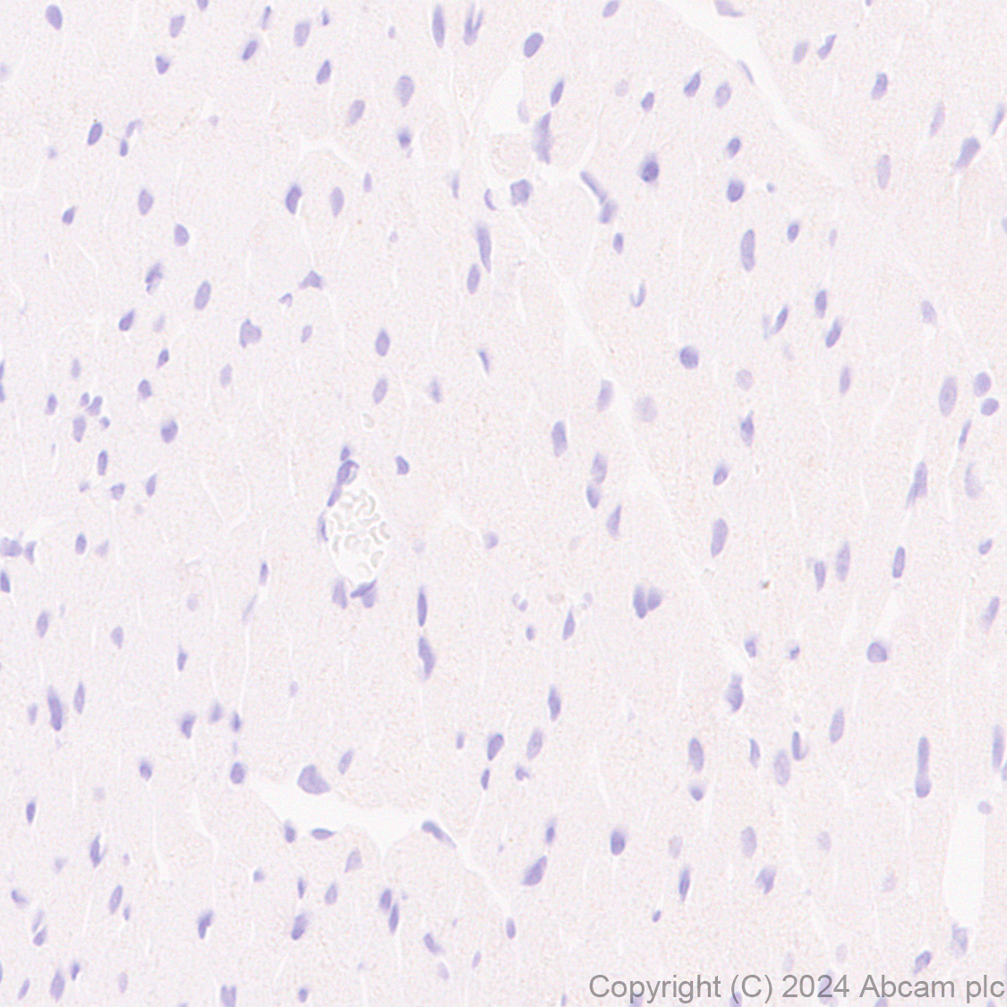 Immunohistochemistry (Formalin/PFA-fixed paraffin-embedded sections) - Anti-Claudin 3 antibody [EPR28731-2] - BSA and Azide free (ab317320), expandable thumbnail