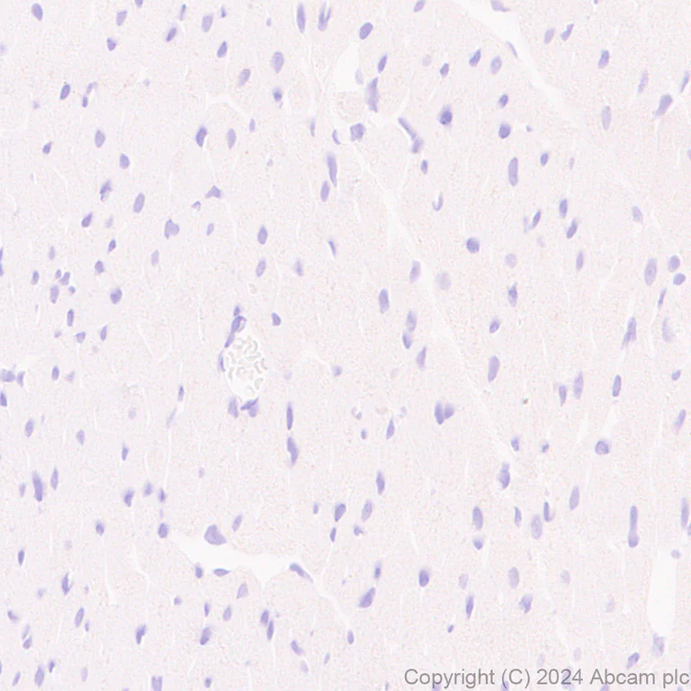 Immunohistochemistry (Formalin/PFA-fixed paraffin-embedded sections) - Anti-Claudin 3 antibody [EPR28731-2] - BSA and Azide free (AB317320)
