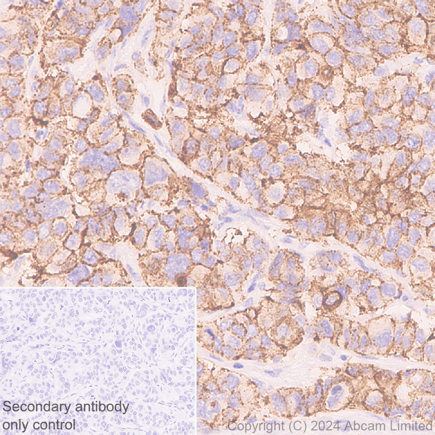 Immunohistochemistry (Formalin/PFA-fixed paraffin-embedded sections) - Anti-Claudin 3 antibody [EPR28731-2] - BSA and Azide free (AB317320), expandable thumbnail