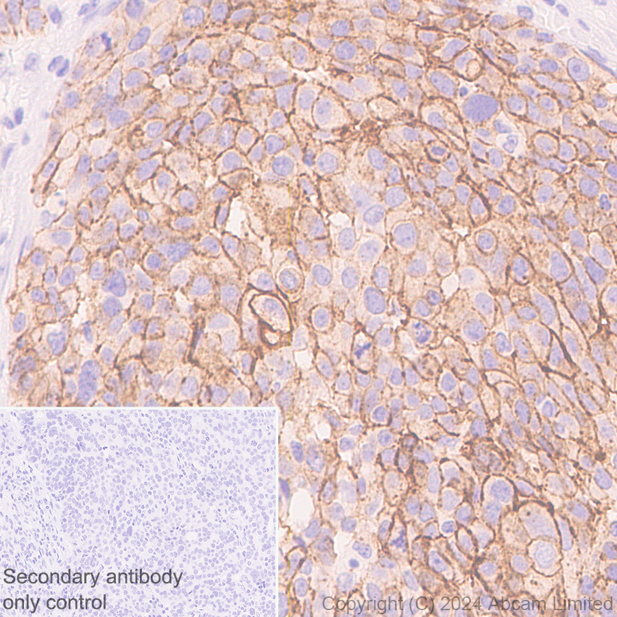 Immunohistochemistry (Formalin/PFA-fixed paraffin-embedded sections) - Anti-Claudin 3 antibody [EPR28731-2] - BSA and Azide free (AB317320), expandable thumbnail