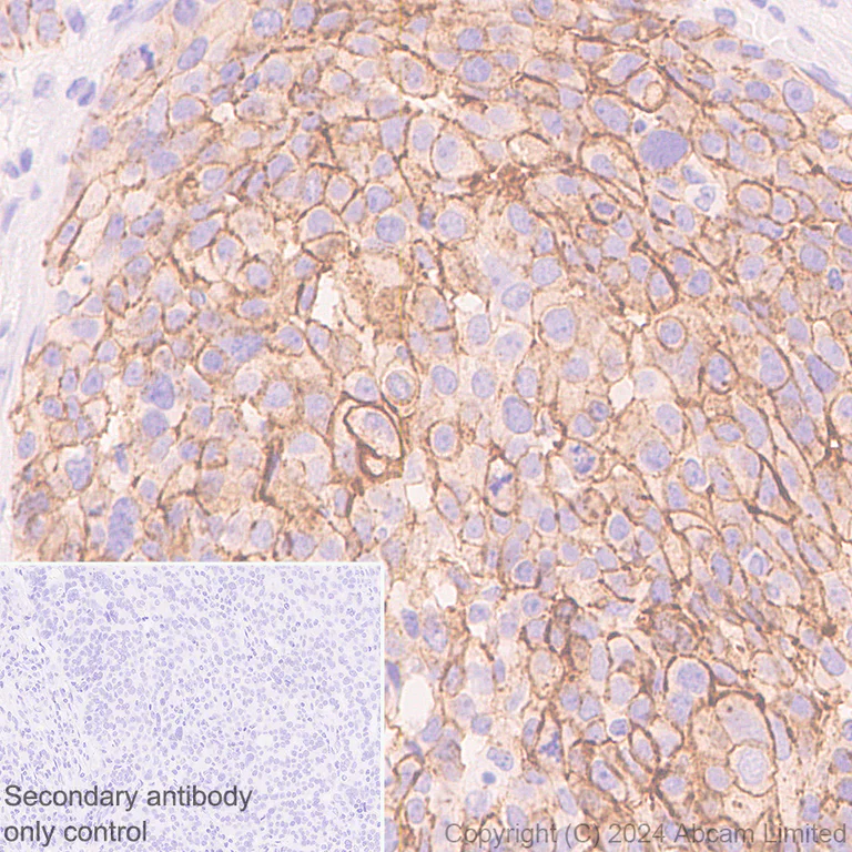Immunohistochemistry (Formalin/PFA-fixed paraffin-embedded sections) - Anti-Claudin 3 antibody [EPR28731-2] - BSA and Azide free (AB317320)