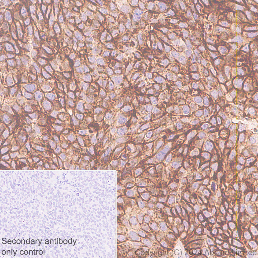 Immunohistochemistry (Formalin/PFA-fixed paraffin-embedded sections) - Anti-Claudin 3 antibody [EPR28731-2] - BSA and Azide free (AB317320), expandable thumbnail