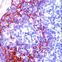 Immunohistochemistry (Formalin/PFA-fixed paraffin-embedded sections) - Anti-Claudin 4 antibody (AB15104)