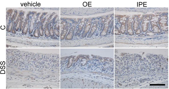 Immunohistochemistry (Formalin/PFA-fixed paraffin-embedded sections) - Anti-Claudin 4 antibody (AB15104)