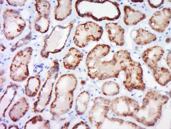 Immunohistochemistry (Formalin/PFA-fixed paraffin-embedded sections) - Anti-Claudin 4 antibody (AB217685), expandable thumbnail