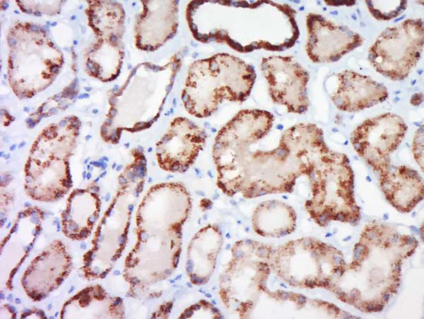 Immunohistochemistry (Formalin/PFA-fixed paraffin-embedded sections) - Anti-Claudin 4 antibody (AB217685)