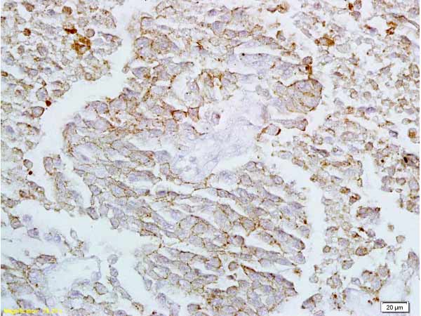 Immunohistochemistry (Formalin/PFA-fixed paraffin-embedded sections) - Anti-Claudin 4 antibody (AB217685), expandable thumbnail