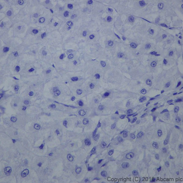 Immunohistochemistry (Formalin/PFA-fixed paraffin-embedded sections) - Anti-Claudin 4 antibody [EPRR17575] (AB210796)