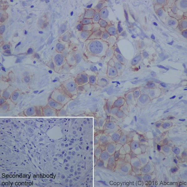 Immunohistochemistry (Formalin/PFA-fixed paraffin-embedded sections) - Anti-Claudin 4 antibody [EPRR17575] (AB210796)