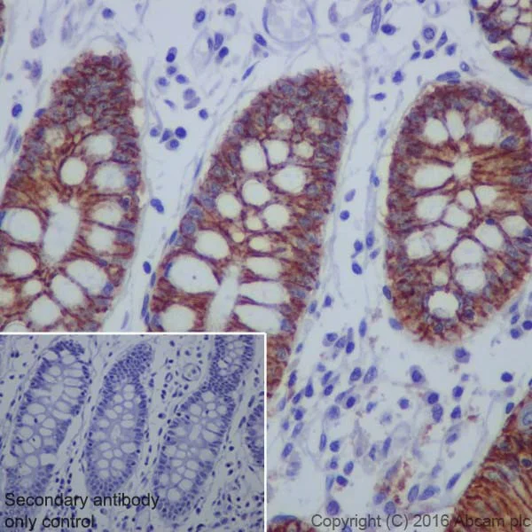 Immunohistochemistry (Formalin/PFA-fixed paraffin-embedded sections) - Anti-Claudin 4 antibody [EPRR17575] (AB210796)