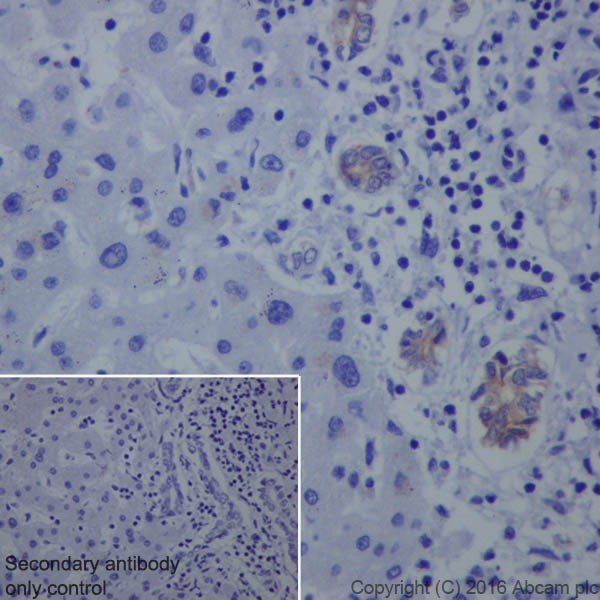 Immunohistochemistry (Formalin/PFA-fixed paraffin-embedded sections) - Anti-Claudin 4 antibody [EPRR17575] - BSA and Azide free (AB240384), expandable thumbnail
