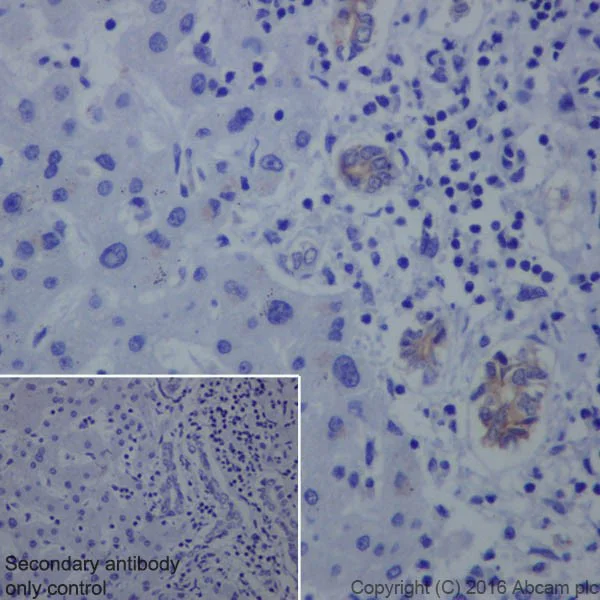 Immunohistochemistry (Formalin/PFA-fixed paraffin-embedded sections) - Anti-Claudin 4 antibody [EPRR17575] - BSA and Azide free (AB240384)