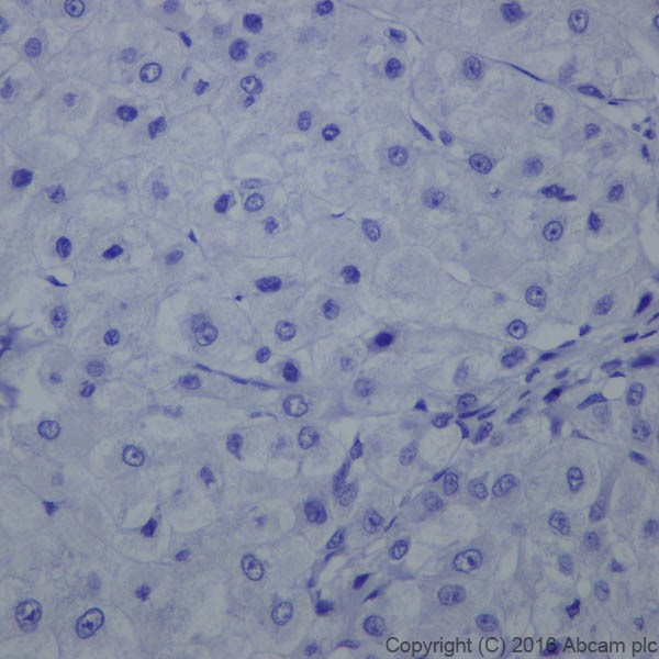 Immunohistochemistry (Formalin/PFA-fixed paraffin-embedded sections) - Anti-Claudin 4 antibody [EPRR17575] - BSA and Azide free (ab240384), expandable thumbnail