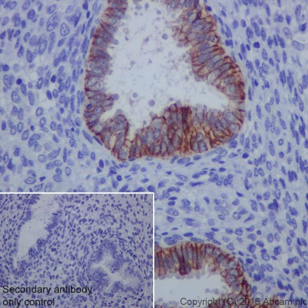 Immunohistochemistry (Formalin/PFA-fixed paraffin-embedded sections) - Anti-Claudin 4 antibody [EPRR17575] - BSA and Azide free (AB240384), expandable thumbnail