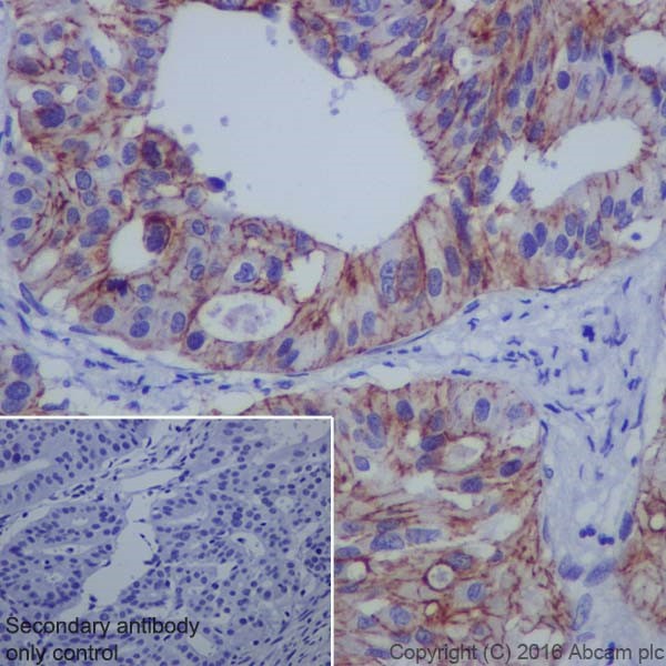Immunohistochemistry (Formalin/PFA-fixed paraffin-embedded sections) - Anti-Claudin 4 antibody [EPRR17575] - BSA and Azide free (AB240384), expandable thumbnail