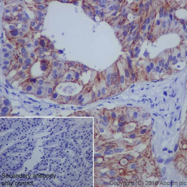 Immunohistochemistry (Formalin/PFA-fixed paraffin-embedded sections) - Anti-Claudin 4 antibody [EPRR17575] - BSA and Azide free (AB240384)