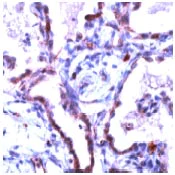 Immunohistochemistry (Formalin/PFA-fixed paraffin-embedded sections) - Anti-Claudin 5 antibody (AB15106)