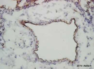 Immunohistochemistry (Formalin/PFA-fixed paraffin-embedded sections) - Anti-Claudin 5 antibody (AB15106)