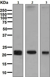Western blot - Anti-Claudin 5 antibody [EPR7583] (AB131259)
