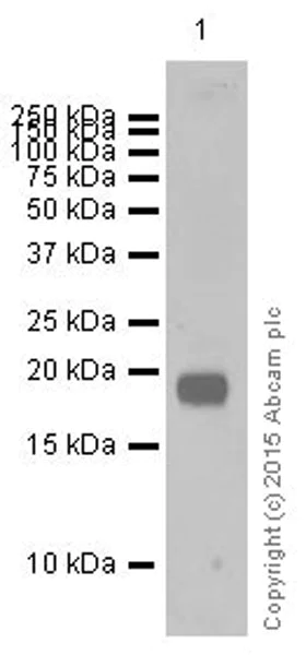 Western blot - Anti-Claudin 5 antibody [EPR7583] (AB131259)